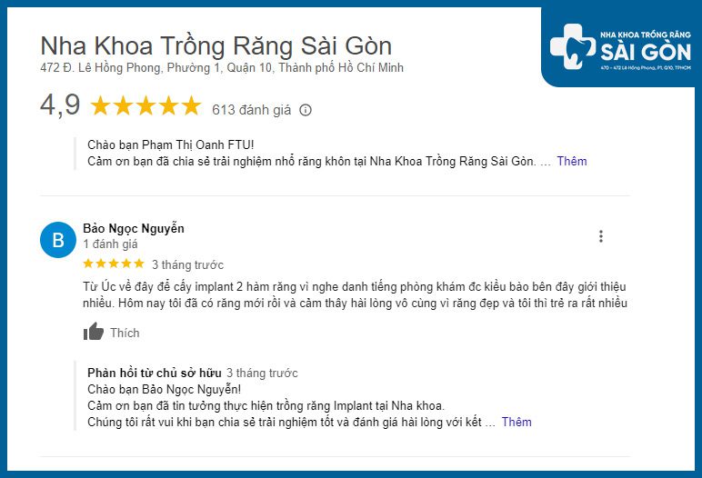 Review nha khoa trồng răng implant