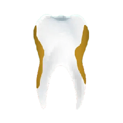 Benh nuou periodontitis
