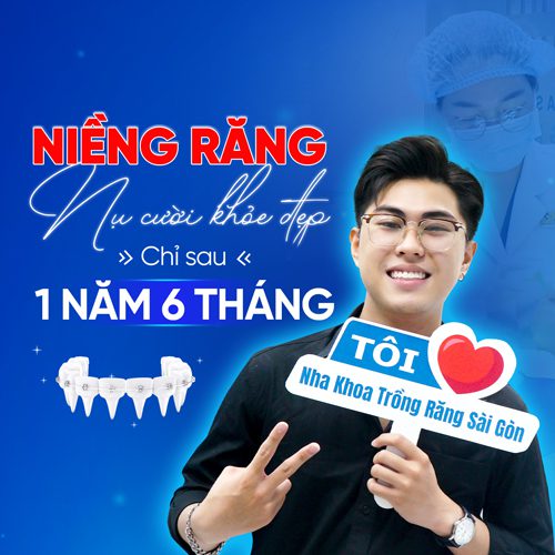 banner nieng rang mobile