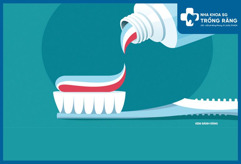 kem đánh răng và nước súc miệng chống vôi răng cũng là giải pháp hữu ích