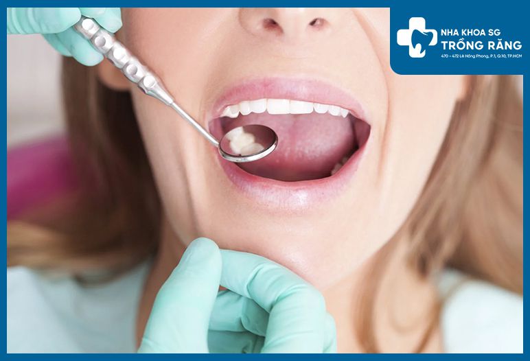 Ngăn ngừa các bệnh về răng miệng