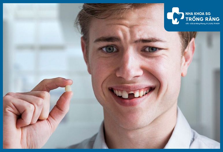 Gãy răng cửa do tai nạn - cần làm gì để khắc phục?