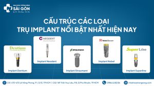 các loại trụ implant