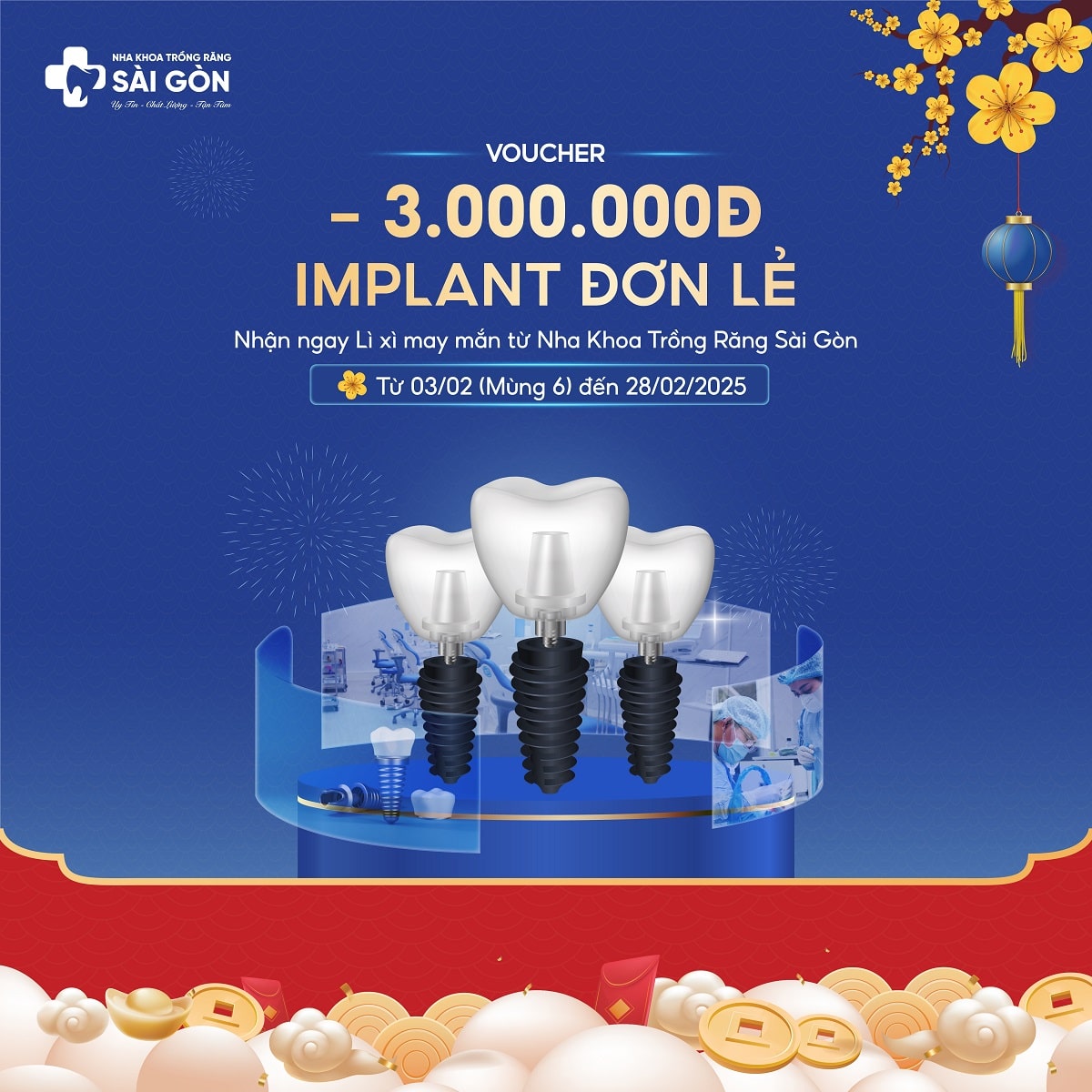 Nha Khoa Trồng Răng Sài Gòn Lì xì trồng răng implant đơn lẻ