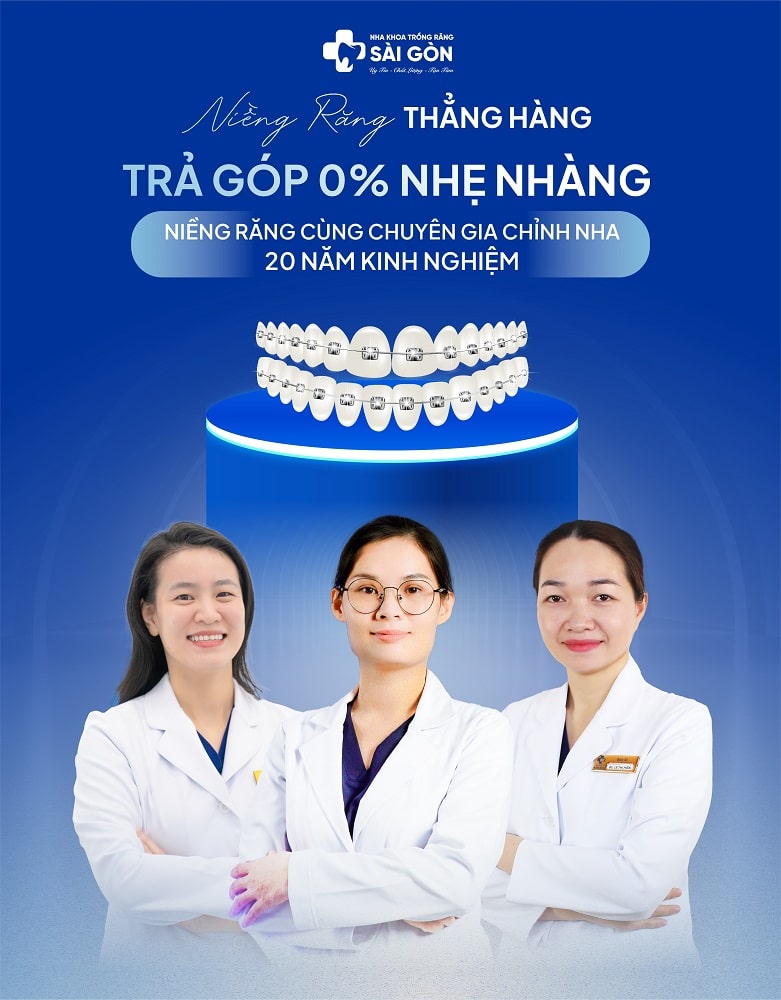 nieng rang tra gop 0 nha khoa sai gon 781x1000 1 Niềng răng trả góp 0% từ Nha Khoa Sài Gòn